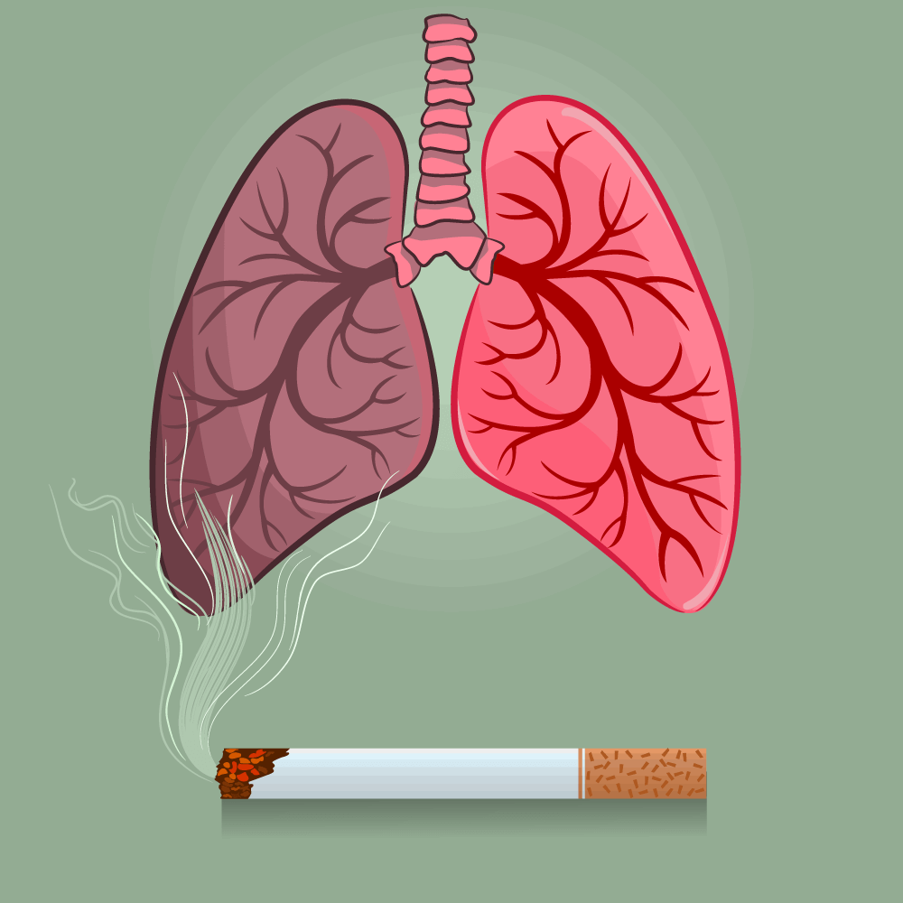 Why You Should Quit Smoking