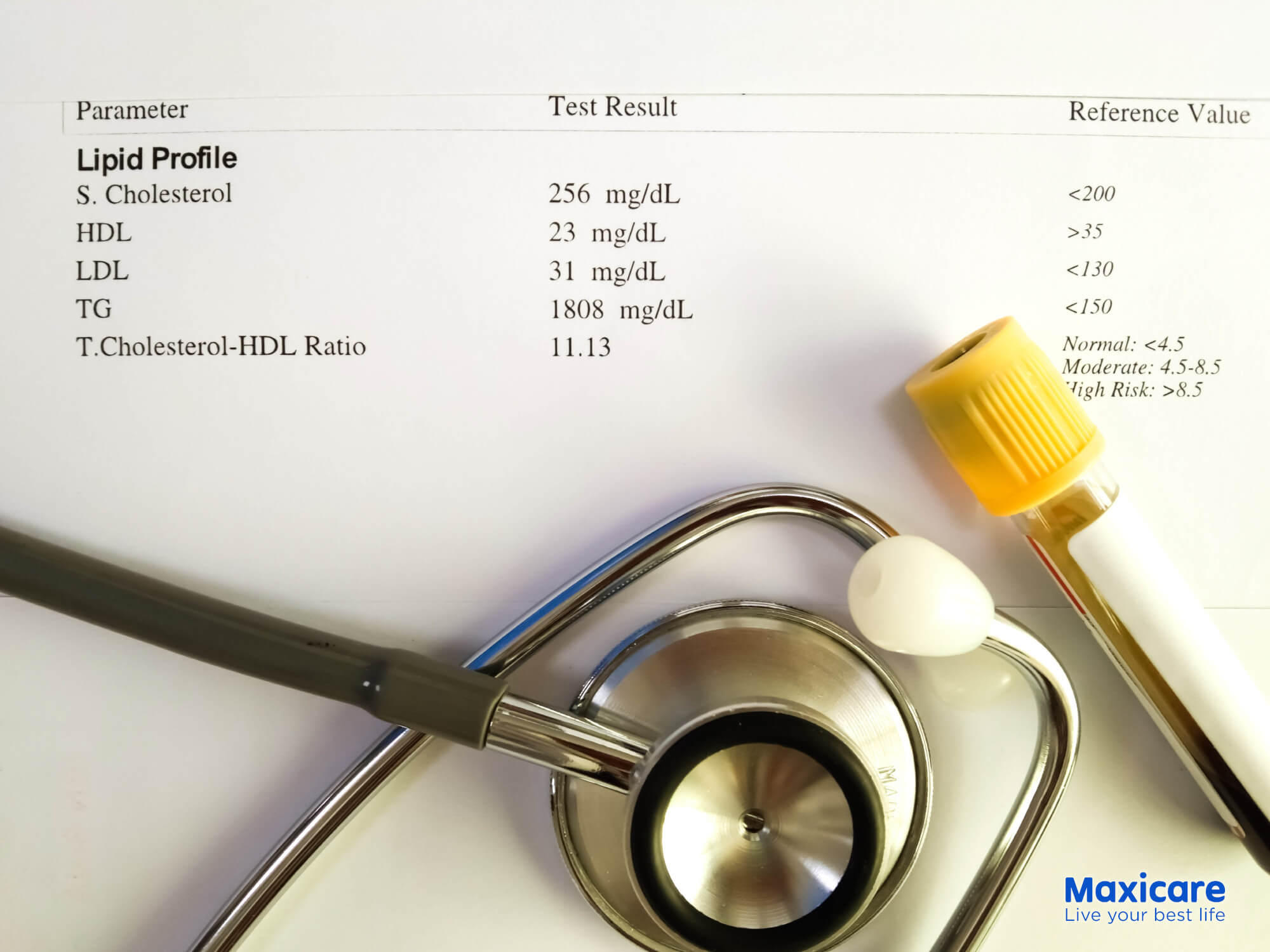 Get your Cholesterol Tested plus 4 other Proven Ways Vs Heart Disease and Stroke